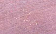 Pinholes